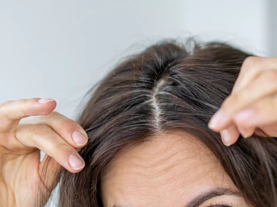 Ich sammle sie während eines Spaziergangs, koche sie und spüle damit meine Haare. Der hausgemachte Aufguss verdeckt graue Haare genauso gut wie beim Friseur und ist zudem kostengünstig.